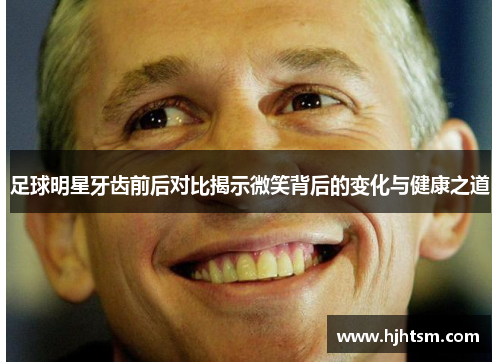 足球明星牙齿前后对比揭示微笑背后的变化与健康之道